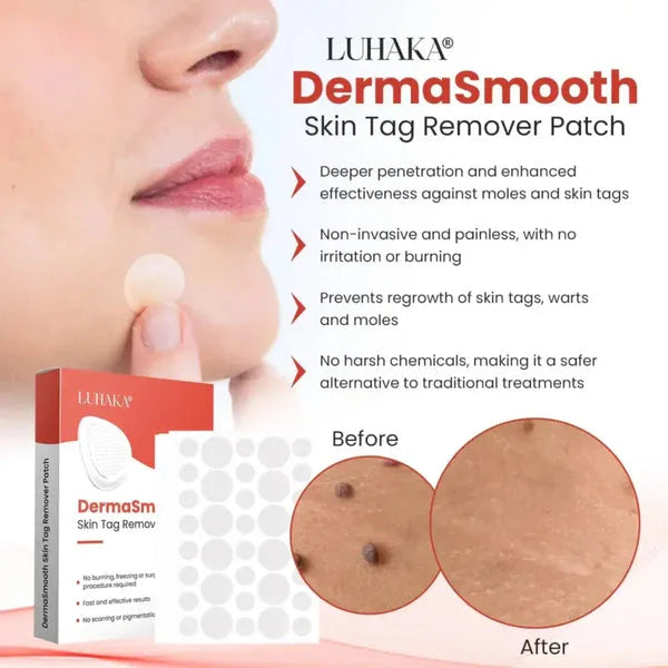 Derma Tag Remover –  for Pimple, Acne & Tag Remover